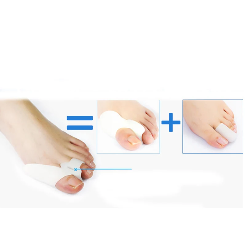 2Pair Foot Bones Silicone Toes Separator Bunion Corrector Big Toe Foot Care Pain Foot Hallux valgus Orthotics Corrective Insole