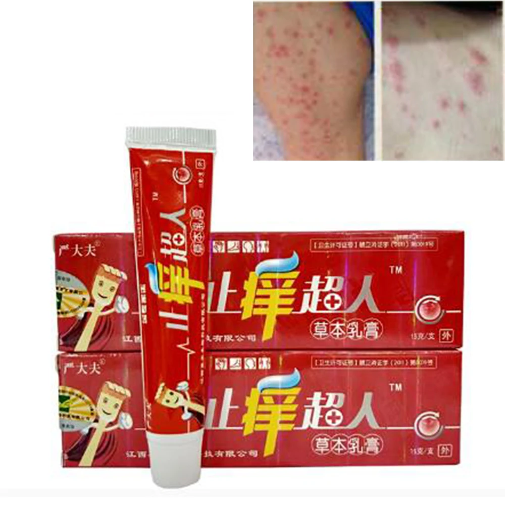 15g Natural Chinese Medicine Herbal Anti Bacteria Cream Psoriasis