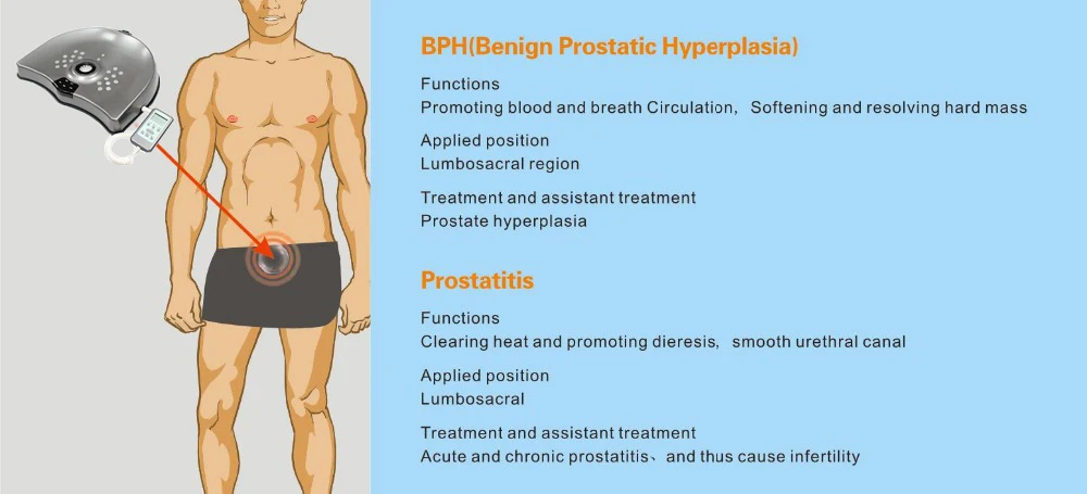 dispositivo de tratamiento de próstata bph dispositivo de tratamiento de próstata bph
