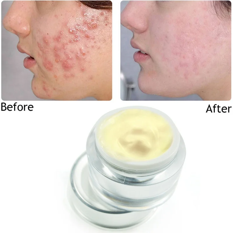 Day Creams Korean Cosmetic Deep Moisturizing Face Cream Hydrating Anti Wrinkle whitening Lift