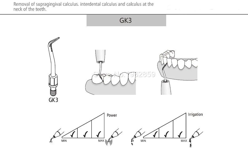 Dicas para Kavo Equipamentos de Ponta Compatível com Kavo Lote Dental Scaler Dentista Instrumento Ultra-sônica Gk1 Gk2 Gk3 Gk4 Gk5 Gk6 Gk7 7 Pçs - 4 Cheap Clareamento dos dentes