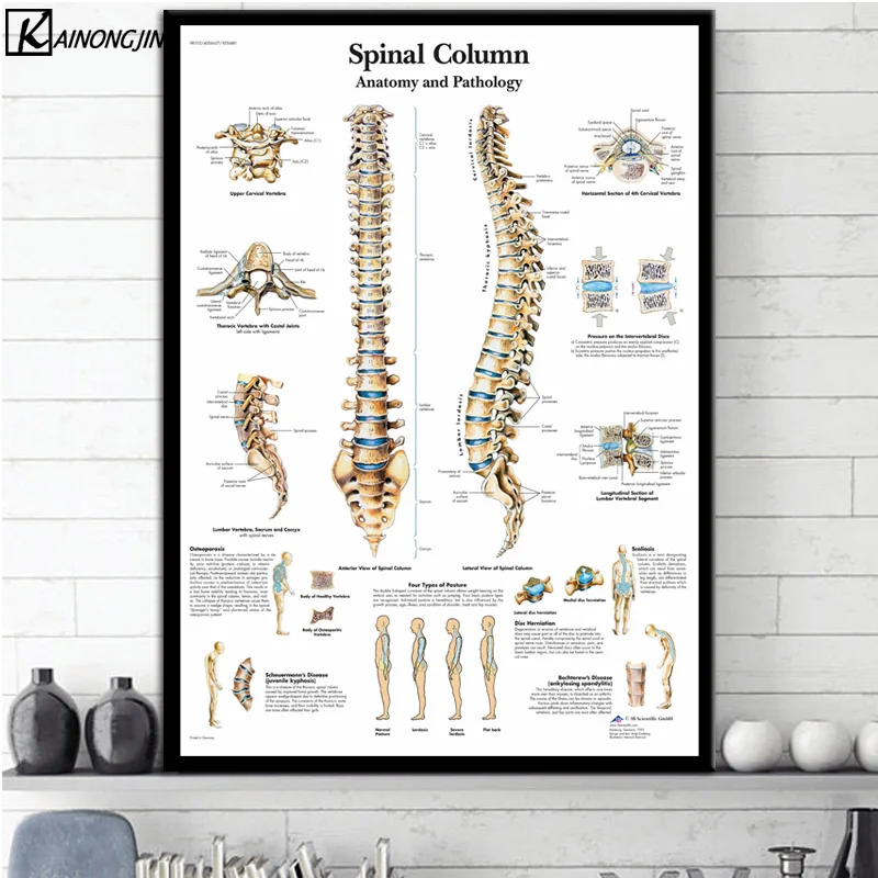 Плакат коленного сустава ноги позвоночника мышцы системы Анатомия плакаты и принты холст картина стены Искусство Картина комнаты домашний декор - Цвет: 0008