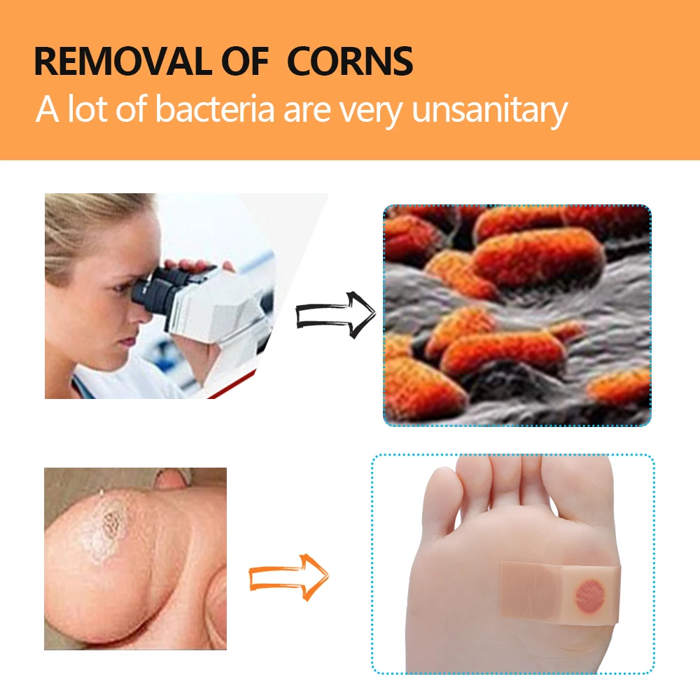 6 шт./партия Отшелушивающий кукурузный пластырь для ног, мягкие ножки, проблемы, удаляет лечение кожи, удаляет подошву для ног, бородаж мозолей C1443