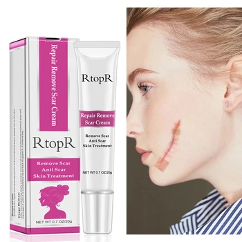

Acne Scar Stretch Marks Remover Cream Skin Repair Face Cream Acne Spots Acne Treatment Blackhead Whitening Cream Skin Care