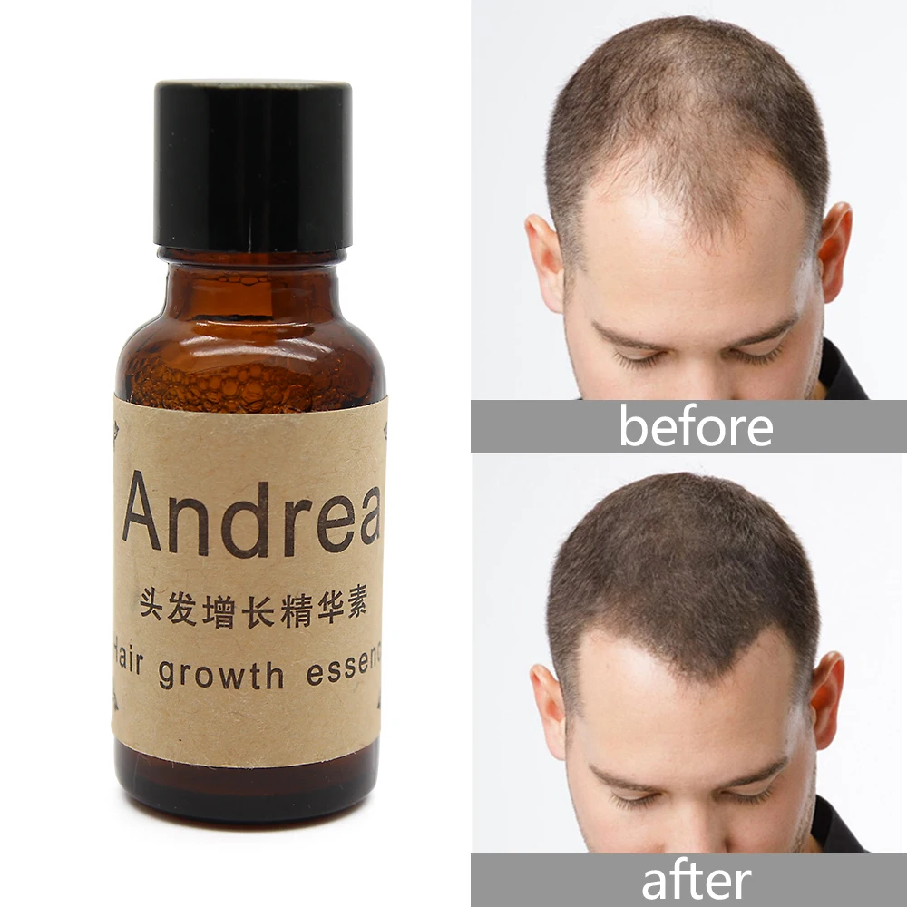 Hair Growth Liquid Dense Hair Fast sunburst hair Growth Anti Alopecia