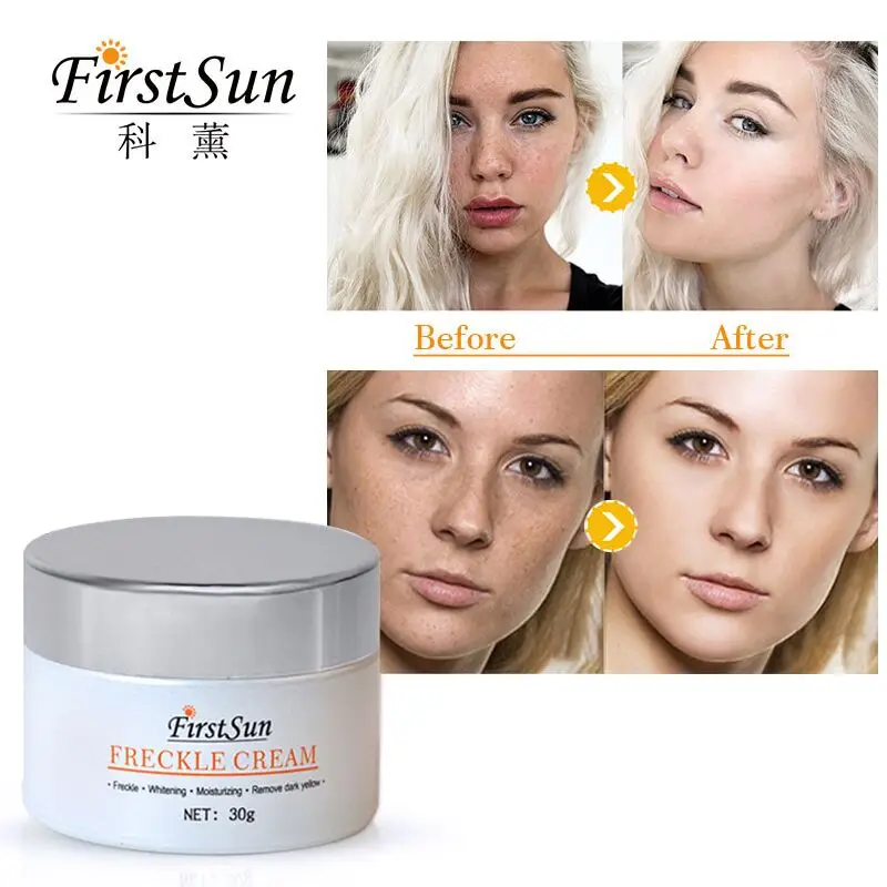

Firstsun Snail Whitening Face Cream Moisturizer Anti-Aging,Wrinkles, Spots, Skin Tone, Firming,Dark Circles Cream Pigment Spots