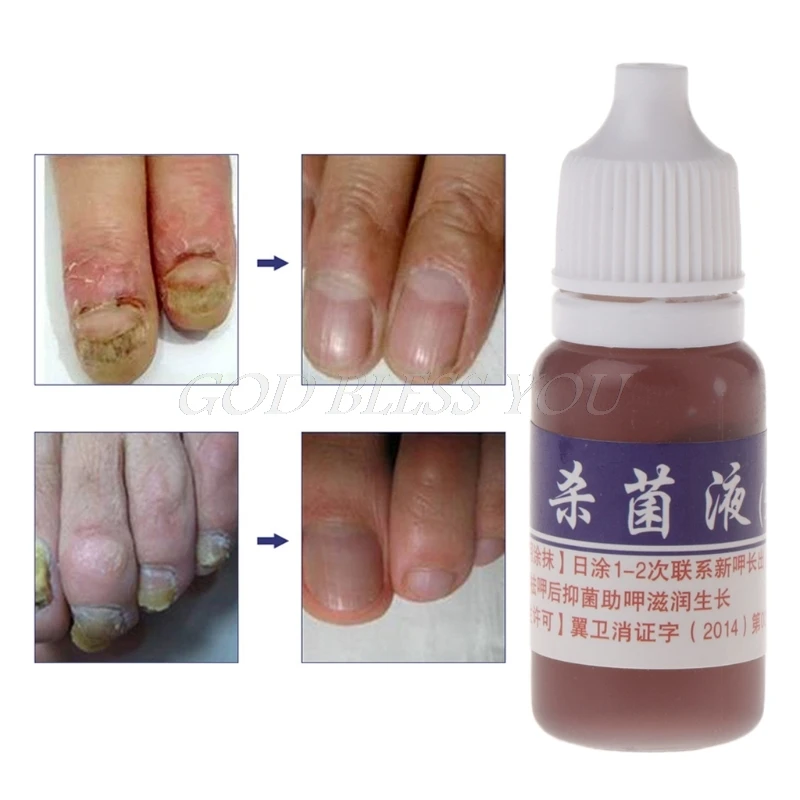 

10ml Nail Repair Onychomycosis Remover Fungus Anti Fungal Toe Treatment Liquid