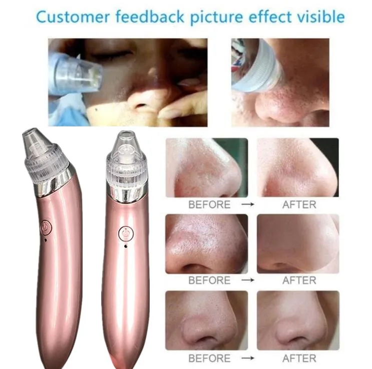 Blackhead Vacuum Electric Pore Cleaner Acne Blackhead Remover Pore