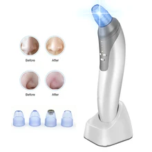 Вакуумное устройство для удаления черных точек инструмент электронный инструмент для очистки пор инструмент для удаления акне использует вакуумный экстрактор пор
