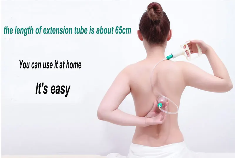 cupping (5)