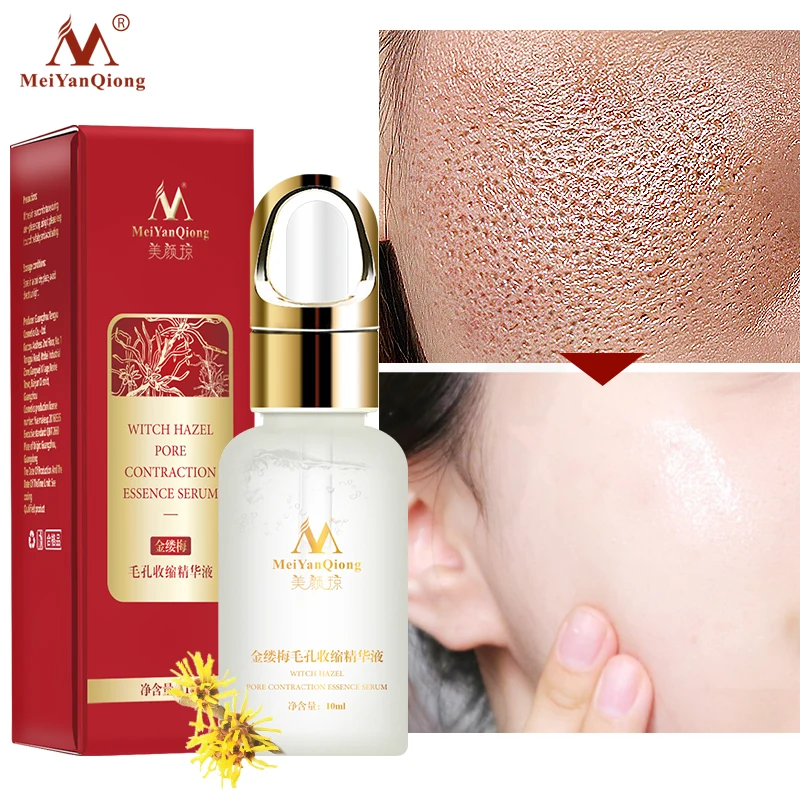 Online Meiyanqing Witch Hazel Pori pori Penyulingan Serum untuk Membersihkan Exfoliating Kulit Mengisi Kelembaban Kulit Wajah 10 Ml