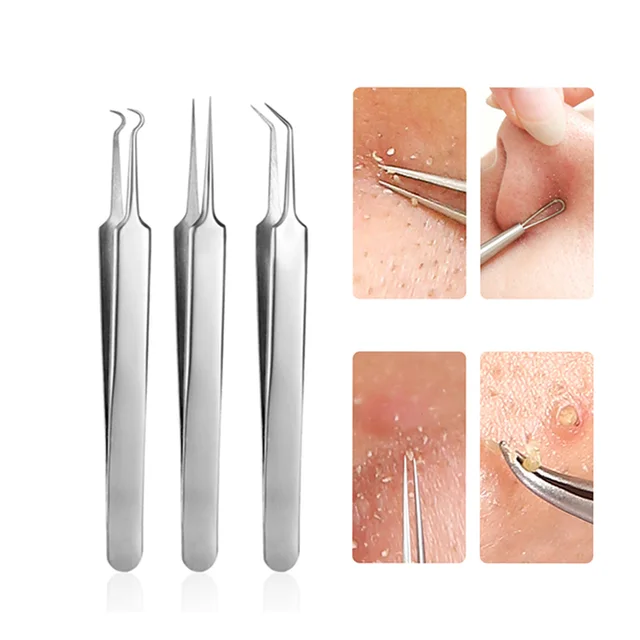 Quality Stainless Steel Blackhead Extractor Blackhead Remover Tweezer