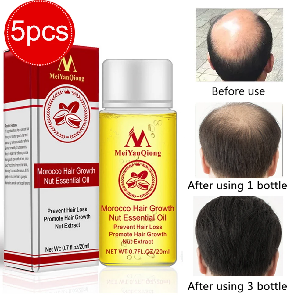Meiyanqiong 5pcs Hair Growth Essence Hair Loss Liquid Anti