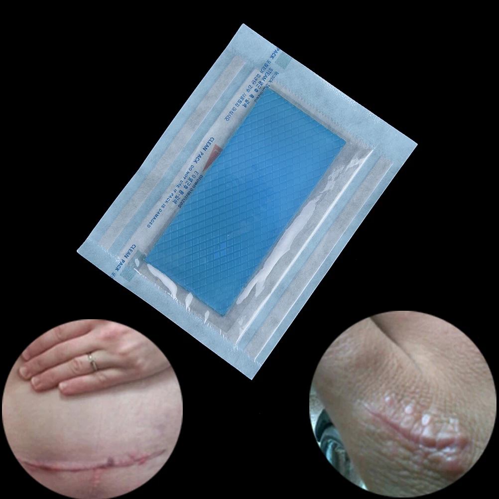 

3.5*12cm Reusable Acne Gel Scar Therapy Silicon Patch Remove Trauma Burn Sheet Skin Repair