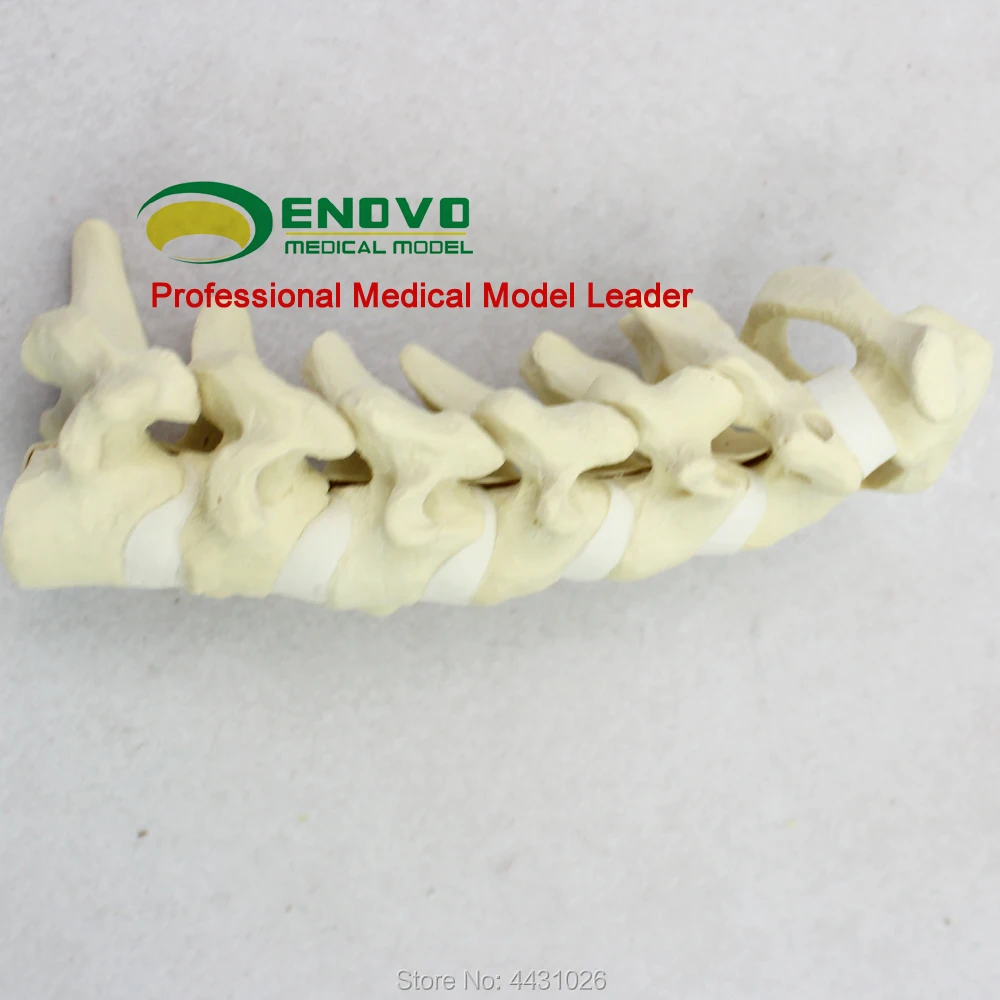 ENOVO Human Cervical Spine Model Anatomy Model Spine Statues Medical Science Teaching