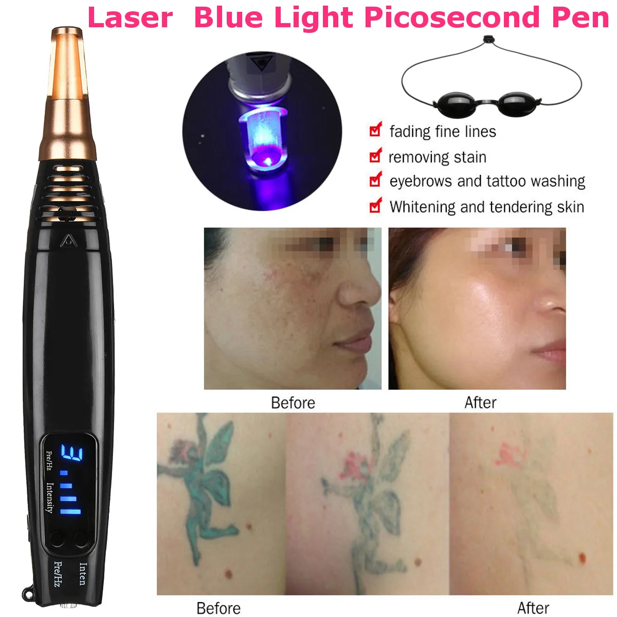 Scar Tattoo Removal Laser Pen Freckle Acne Mole Dark Spot Pigment Tattoo Removal Beauty Machine Pro Repair Picosecond Pen