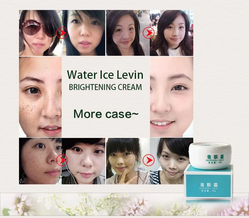 Водный ледяной Левин экстракт против пятен крем для лица выцветает темные пятна лица против морщин лечение акне, увлажнение отбеливающий крем