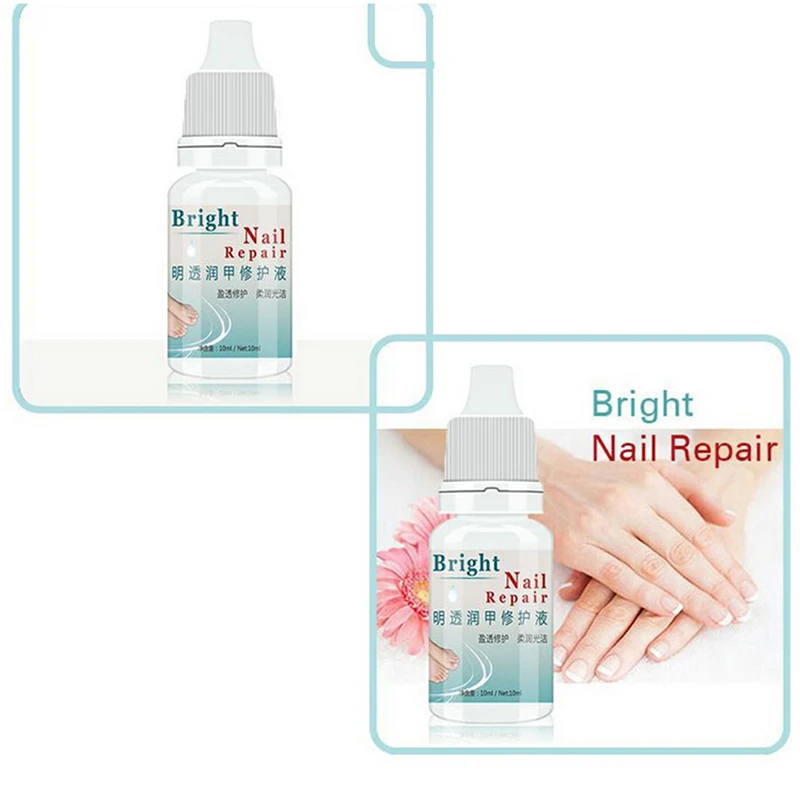 10ml/Bottle Fingernail Toenail Treatment Nail Repair Liquid Finger