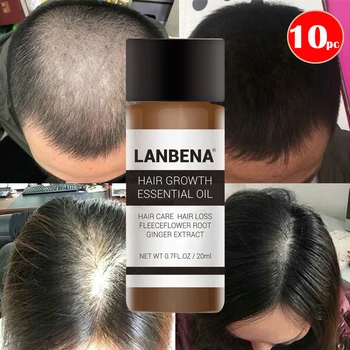 

10pcs LANBENA Growth Essence Hair Treatment Hair Loss Essential Oil Product for Men Women Repair Hair Set