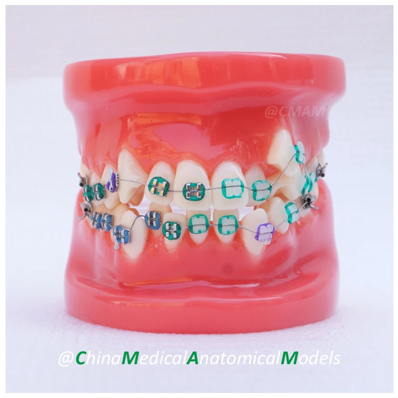 

13019 DH201-1 Orthodontic Model, Dentist Gift Oral Dental Ortho Metal Model, China Medical Anatomical Model