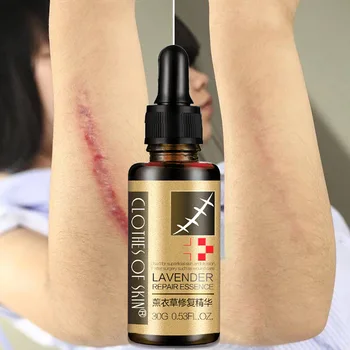 

Lavender Essential Massage Oil Stretch Marks Scar Removal Oil For Pregnant Women Hyaluronic Acid Serum Essential Body Skin Care