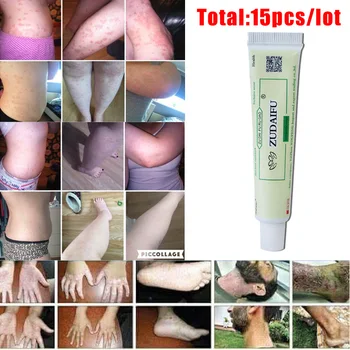 

15pieces per lot ZUDAIFU Skin Conditions Effective Remove Psoriasis Eczema Peeling Treatment Anti Fungus without retail box