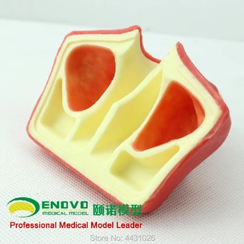 ENOVO Dental implant training on maxillary sinus augmentation of maxillary sinus ENOVO Dental implant training on maxillary sinus augmentation of maxillary sinus