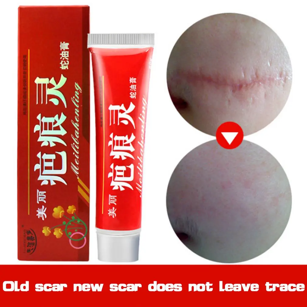 Травяной китайской медицины крем от прыщей крем шрам гель Удаление Шрама от акне 60 г кожи ремонт лечение для лица и всего тела