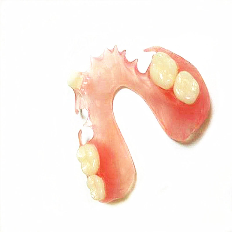 Definition De Dentier En Francais  : Sustantivo De Género Exclusivamente Femenino, Que Lleva Los Artículos La O Una En Singular, Y Las O Unas En Plural.