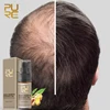 PURC Hot sale Fast Hair Growth Essence Oil Hair Loss Treatment Help for hair Growth Hair Care 20ml ► Photo 3/6