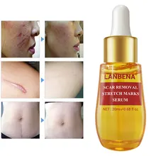 Удаляет рубцы после акне Сыворотка для лечения акне средство для удаления растяжек против угревой сыпи сужение пор отбеливающий крем для ухода за кожей