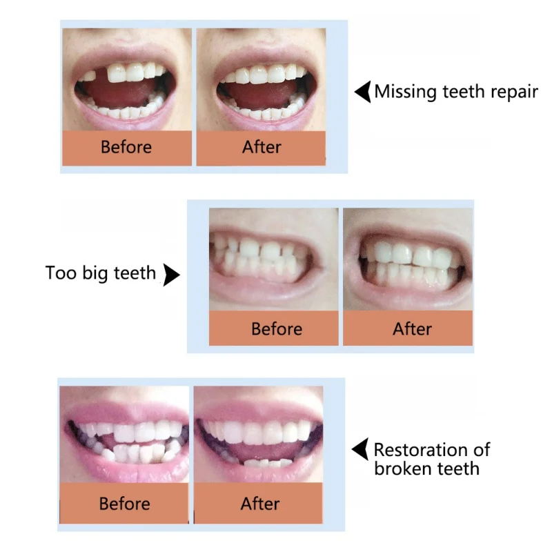 Набор для ремонта зубов из смолы, твердый клей, временные зубья и зазоры, твердый клей для зубных протезов, клей для зубных протезов
