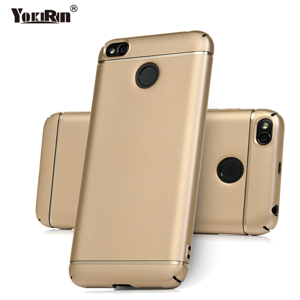 YOKIRIN Luxury Mobile Phone Case Coque For Xiaomi Redmi 4X Cover Mi A1 5X Red Rice Hard PC Shell Back 5.0 inch Capa | Мобильные
