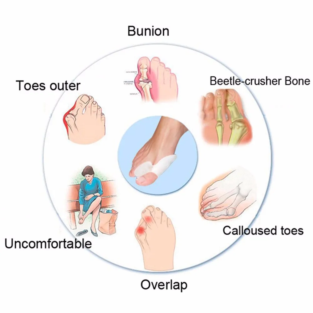 1 пара специальная защита от вальгусной деформации для езды на велосипеде с накатанной головкой ортопедические Брекеты для исправления ортопедии ежедневно силиконовый палец на ноге большая кость уход Z27601