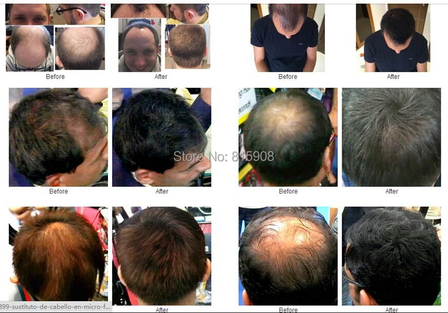 Кератиновые Волокна Для Волос Купить