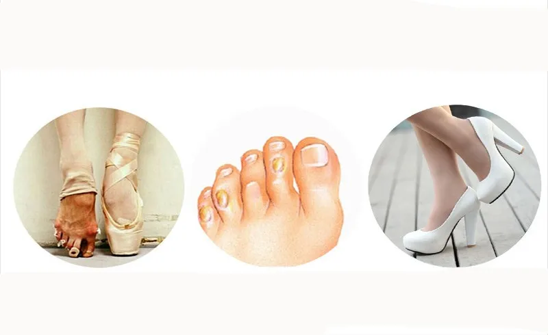 Pares de Balé Dedo do pé Pointe Silicone Protetor Capa pé Manga Palma Antepé Palmilhas Toe Proteção Grande Almofadas 35 3 antepé palmilhas toe capa proteção toe grande almofadas