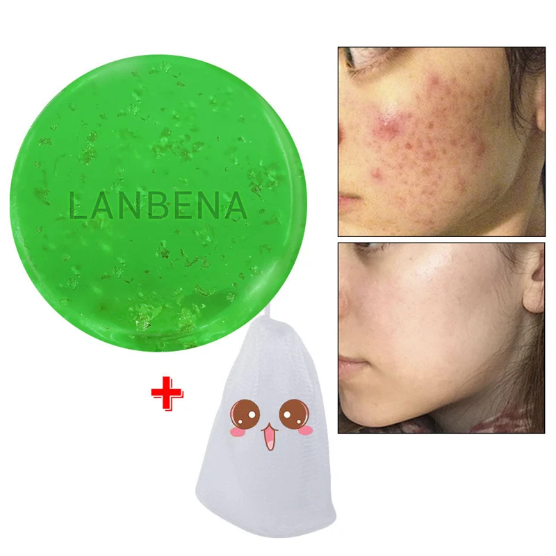 

LANBENA Tea Tree Handmade Soap Face Essential Oil Facial Cleansing Acne Treatment Moisturizing Blackhead Remover Anti-Aging