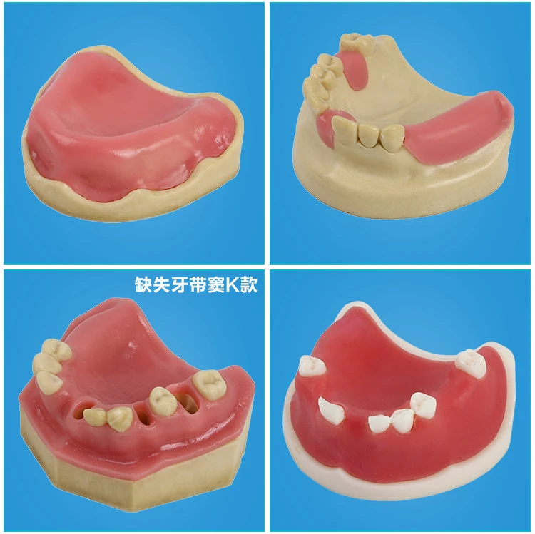 Стоматологические материалы модель орального имплантата хирургические maxillary sinus Стоматологические принадлежности оборудование инструменты мягкие десны