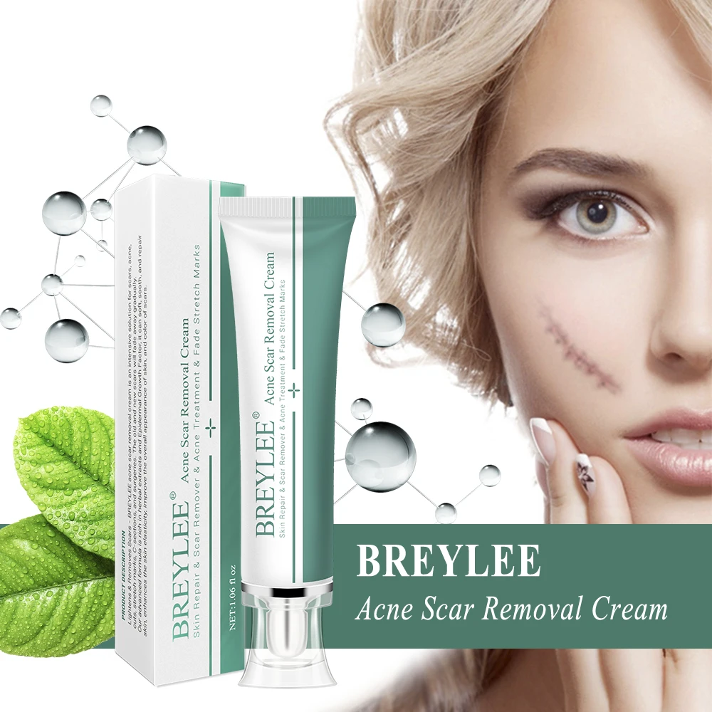 

BREYLEE Acne Scar Removal Cream 30g Face Cream Skin Repair Scar Acne Treatment Remove Stretch Marks Whitening Cream Skin Care