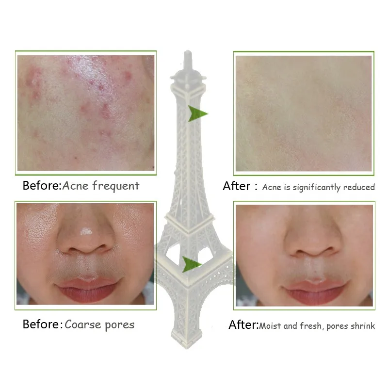 50 г водоросли алоэ вера отбеливающий гель день кремы Acne антивозрастной против морщин Отбеливание Коллагена лица Осветляющий крем уход за
