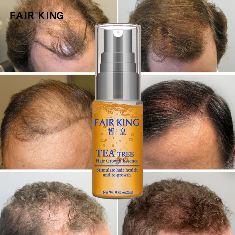 Чайное дерево средство для роста волос от магазина FAIR_KING_Official Store - фото