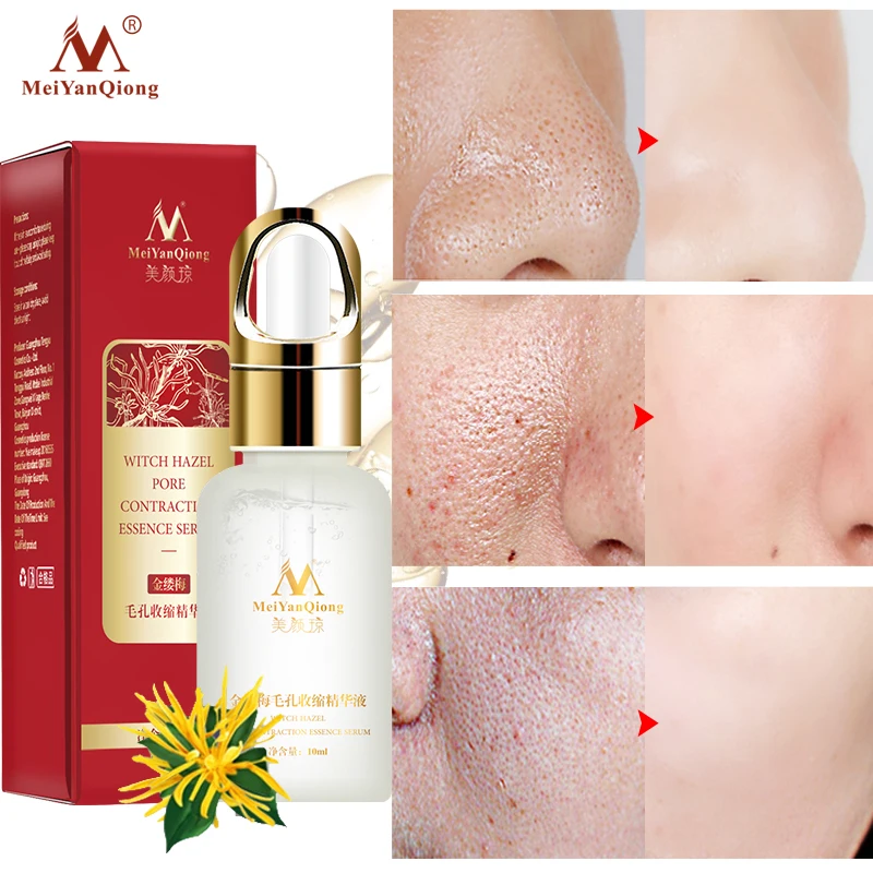 Murah Witch Hazel Pori Mengurangi Esensi Firming Kulit Dalam Pelembab Meningkatkan Elastisitas Kulit Mencerahkan Kulit Wajah Perbaikan 10 Ml