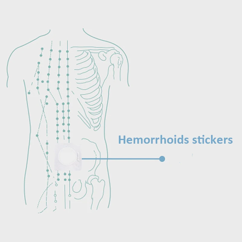 20 шт Анти-геморрой пластырь внутренний геморрой сваи колодки эффективное устранение внешнего анального раскола смешанного геморроя