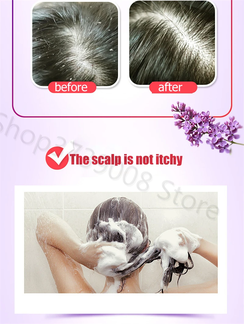 MOFAJANG Профессиональный эфирное масло ароматерапия шампунь для волос контроль над маслом против перхоти поврежденные восстанавливающие продукты для ухода за волосами 500 мл
