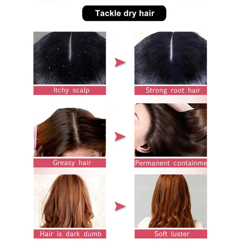 Имбирная эссенция способствует росту густых волос быстрое лечение жидкость питает кожу головы волосы против выпадения волос сыворотка красота продукт