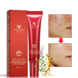 Новый MeiYanQiong лица по уходу за кожей травяной Очищение анти-акне гель 15 ml лечение крем для лица Уход за лицом кожа