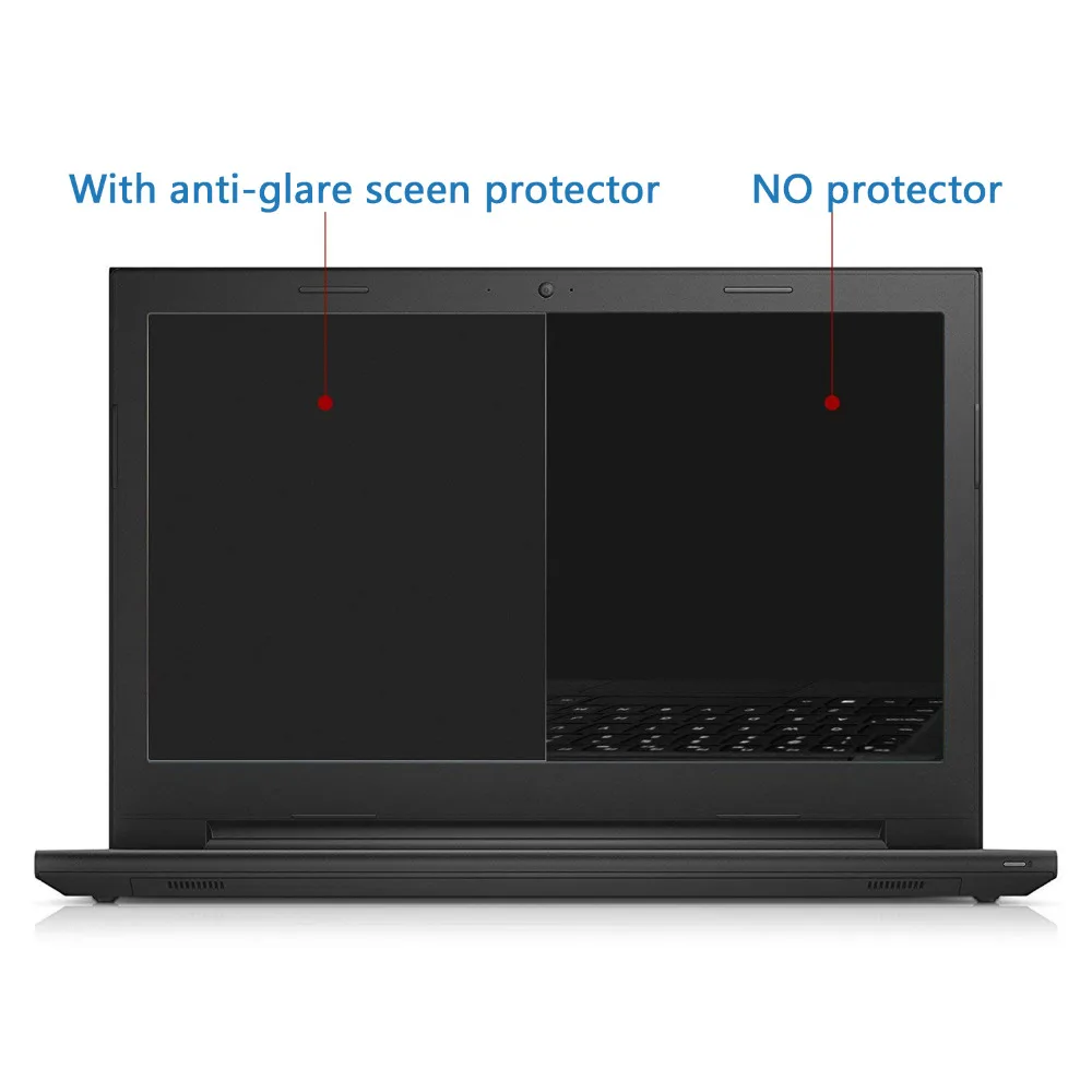 5 шт./лот для lenovo 15,6 дюймов R720 Y720 Y520 Y730 защитная плёнка для экрана ноутбука ноутбук Антибликовая матовая/Hig прозрачная пленка для ЖК-экрана
