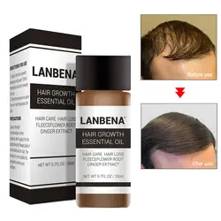 Эфирная масляная эссенция для роста волос быстрое мощное лечение предупреждающий потерю волос Уход TY99