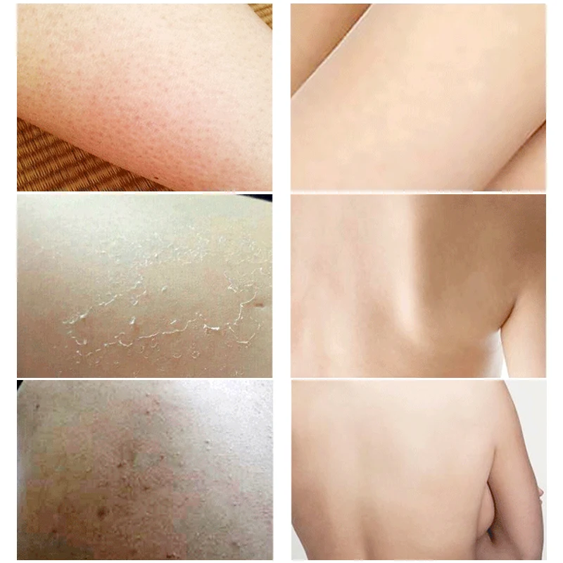 MEIKING New Smooth Body Cream Whitening Moisturizing lotion Repair Whole Body Dark Skin Moisturizer Exfoliation Skin Care 150g MEIKING New Smooth Body Cream Whitening Moisturizing lotion Repair Whole Body Dark Skin Moisturizer Exfoliation Skin Care 150g