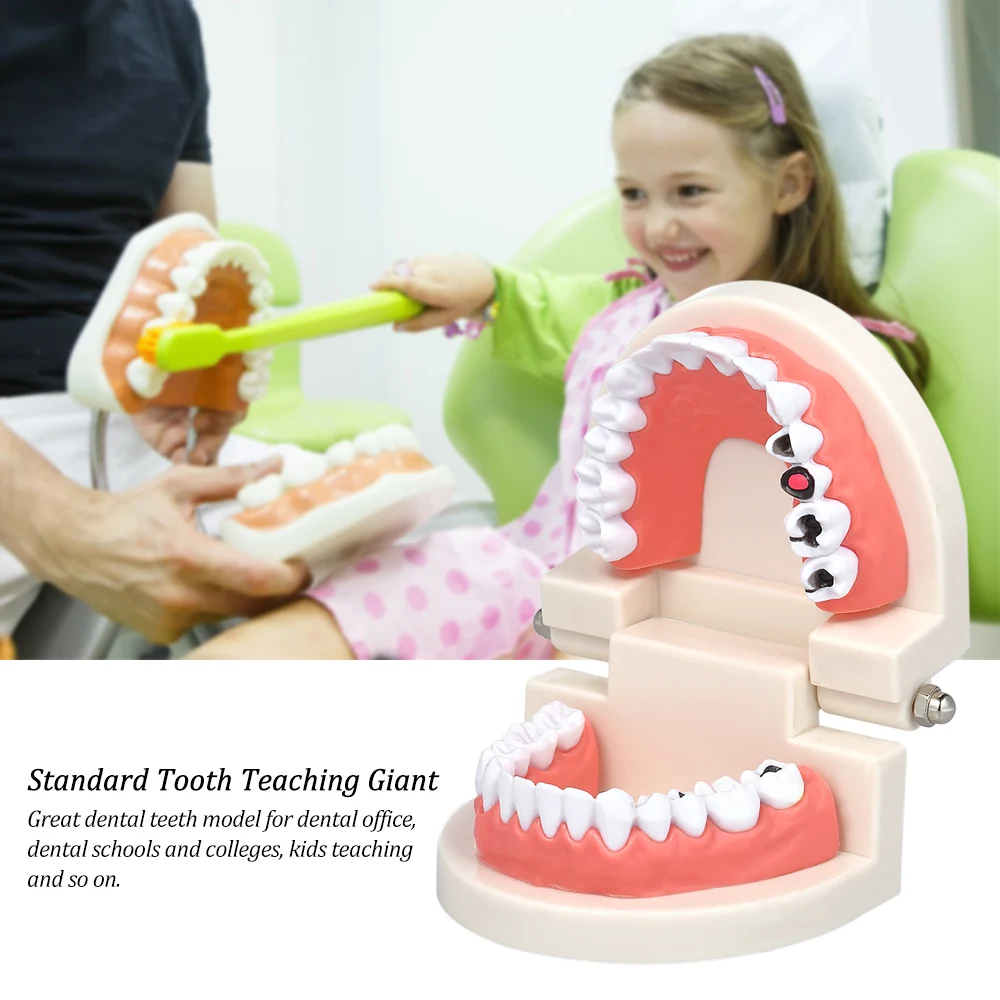 

Standard Tooth Teaching Giant Dental Dentist Teeth Model Child Kidtraining Model Disease Teeth Medical Model